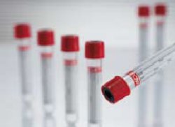 VACUETTE® Z Serum Clot Activator Venous Blood Collection Tube Clot Activator Additive 6 mL Pull Cap