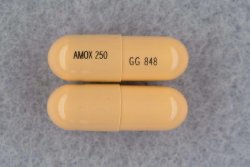 Amoxicillin 250 mg Capsule 500 Capsules